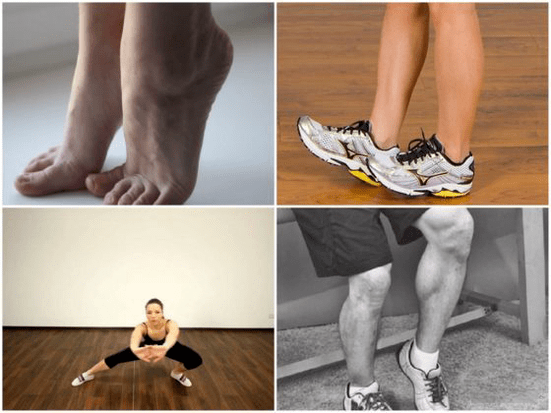 varizes causam dor nas pernas